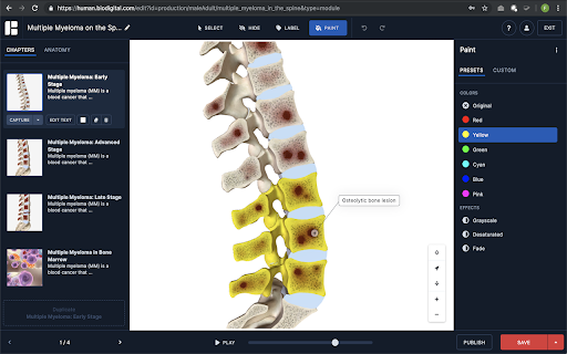 BIODIGITAL HUMAN from Chrome web store to be run with OffiDocs Chromium online BIODIGITAL HUMAN from Chrome web store to be run with OffiDocs Chromium online